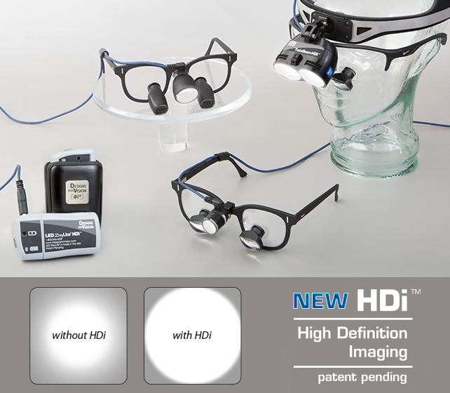 hdi 1